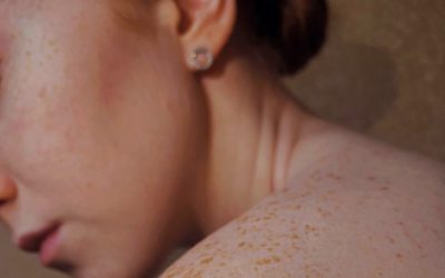 Qué es la microbiota cutánea y cómo cuidarla